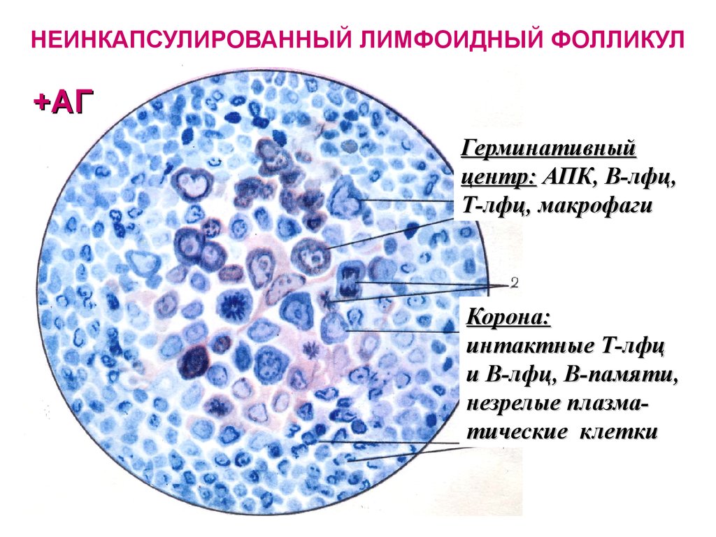 Лимфоидные фолликулы. Лимфоидные фолликулы строение гистология. Герминативный центр лимфатического узла. Лимфоидный фолликул строение гистология. Строение лимфатического фолликула.