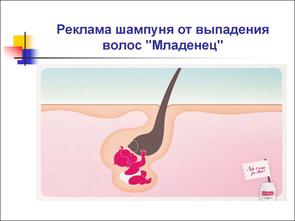 Реклама шампуня от выпадения волоc "Младенец"