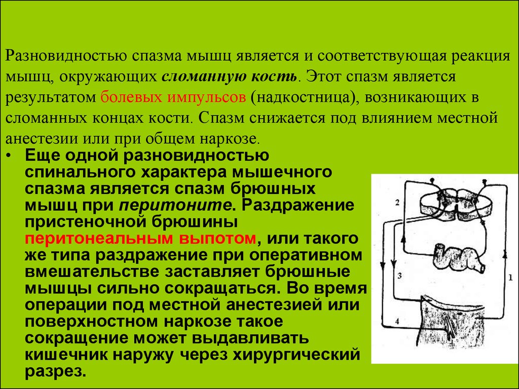 Спазм это. Спазм в мышцах и его влияние на костные структуры. Спазмированные мышцы. При остром мышечном спазме необходимо. Спастическое сокращение мышц.