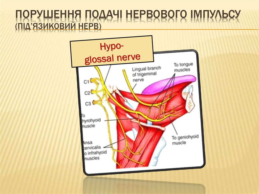 порушення Подачі нервового імпульсу (під’язиковий нерв)
