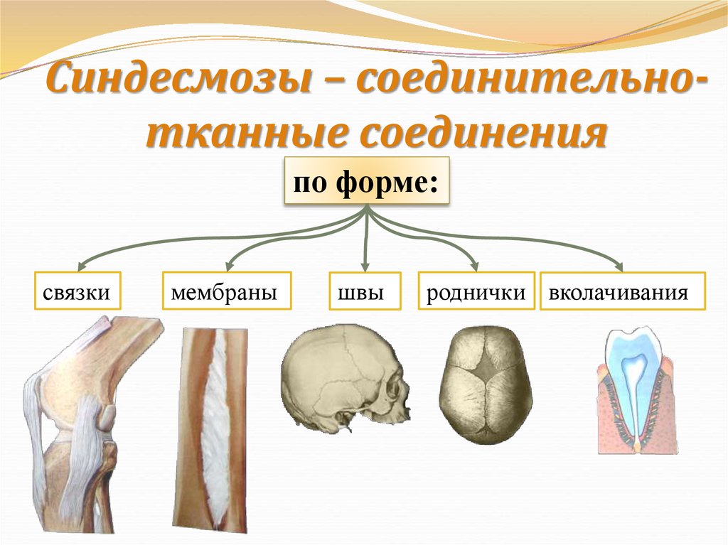 Перечислите соединение костей. Соединение костей синдесмозы. Фиброзные соединения синдесмозы. Синдесмозы связки мембраны швы. Соединения костей синдесмозы фиброзные.