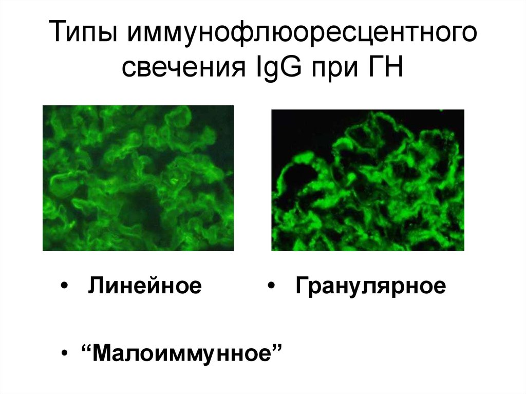 Антитела к базальной мембране. Иммунофлюоресцентный анализ. Гранулярные клетки почки. Ядерный гранулярный Тип свечения АС-2.4.