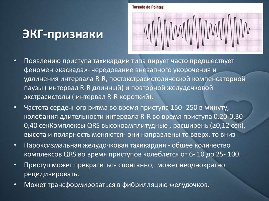 Аритмии презентация факультетская терапия