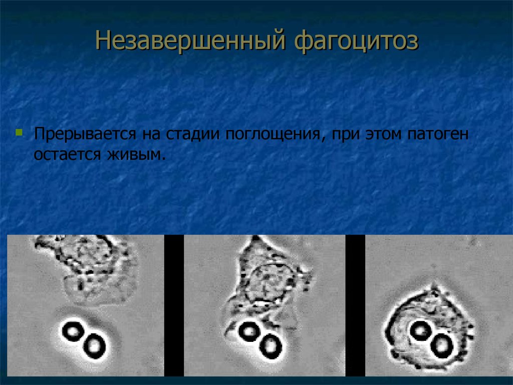 Незавершенный фагоцитоз гонококков в организме человека рисунок