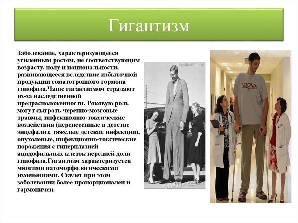 Легенды о людях низкого роста как называются. Заболевания эндокринной системы гигантизм. Гипофизарный гигантизм причины.