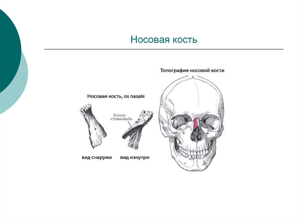 Носовая кость. Носовая кость кость 1.7. Носовая кость вид сбоку. Носовая кость рисунок вид спереди.