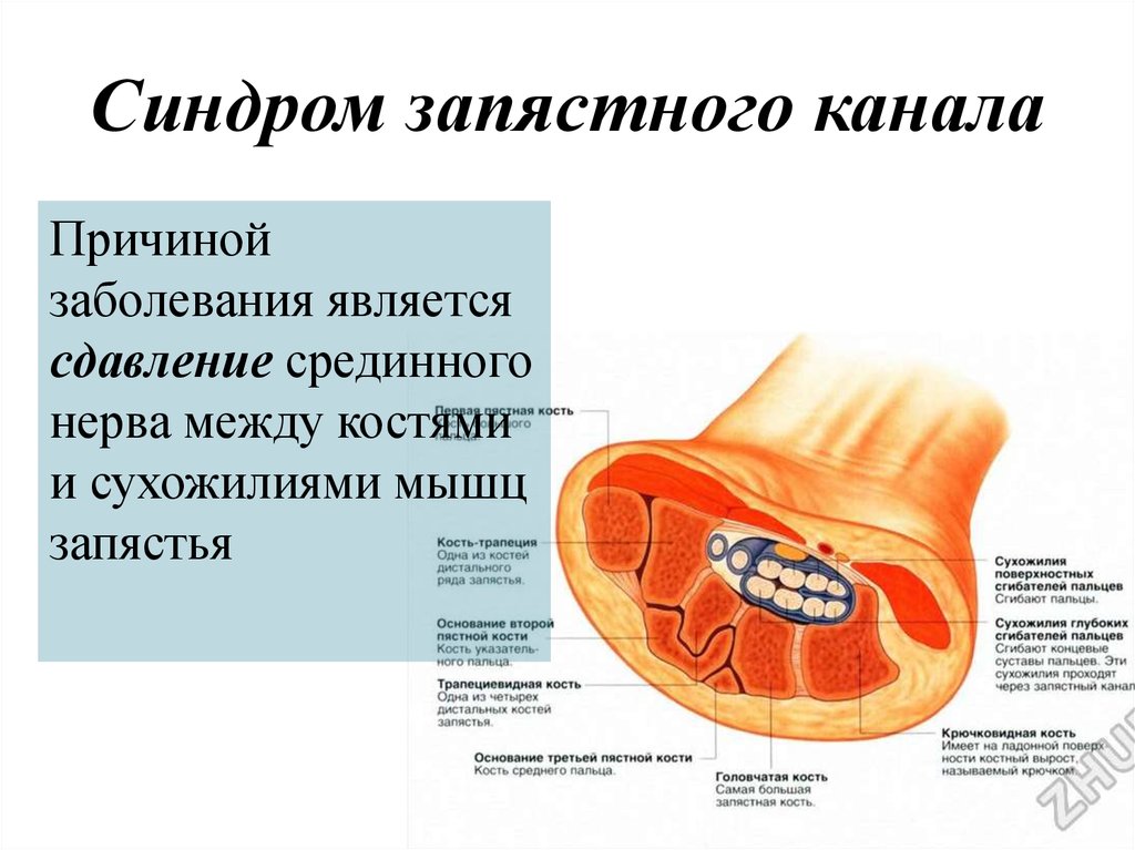 Канал без причины