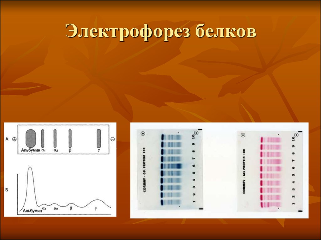 Электрофорез белков. Электрофорез Разделение белков. Электрофоретического исследования белков. Электрофорез белков принцип метода.