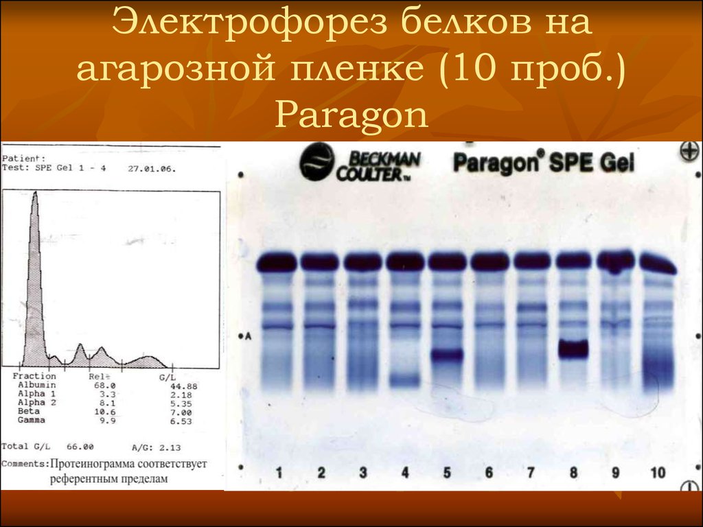 Электрофорез белков. Электрофорез белков сыворотки крови принцип метода. Электрофорез белков биохимия. Электрофорез белков сыворотки крови биохимия. Разделение белков методом электрофореза.