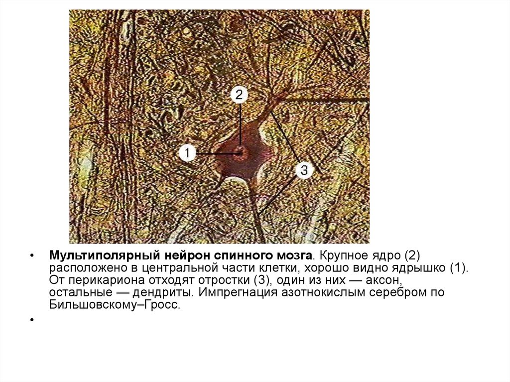 Клетки спинного мозга. Мультиполярный Нейрон импрегнация серебром. Мультиполярный Нейрон спинной мозг импрегнация серебром. Мультиполярные Нейроны спинного мозга препарат. Мультиполярный Нейрон препарат.