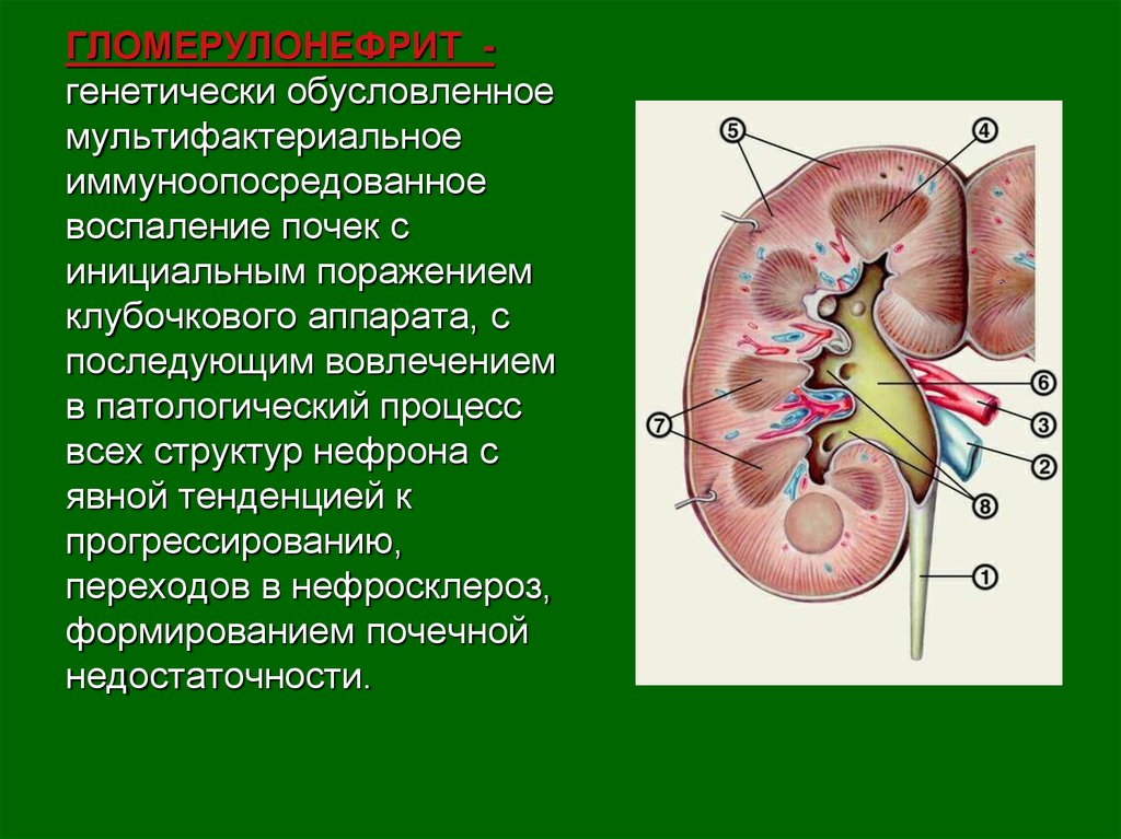 Ткани почки. Поражение клубочкового аппарата почек. Поражение гломерулярного аппарата почек. Восплительное пораженияклубочкового аппарата почек. Патологические процессы в почках.