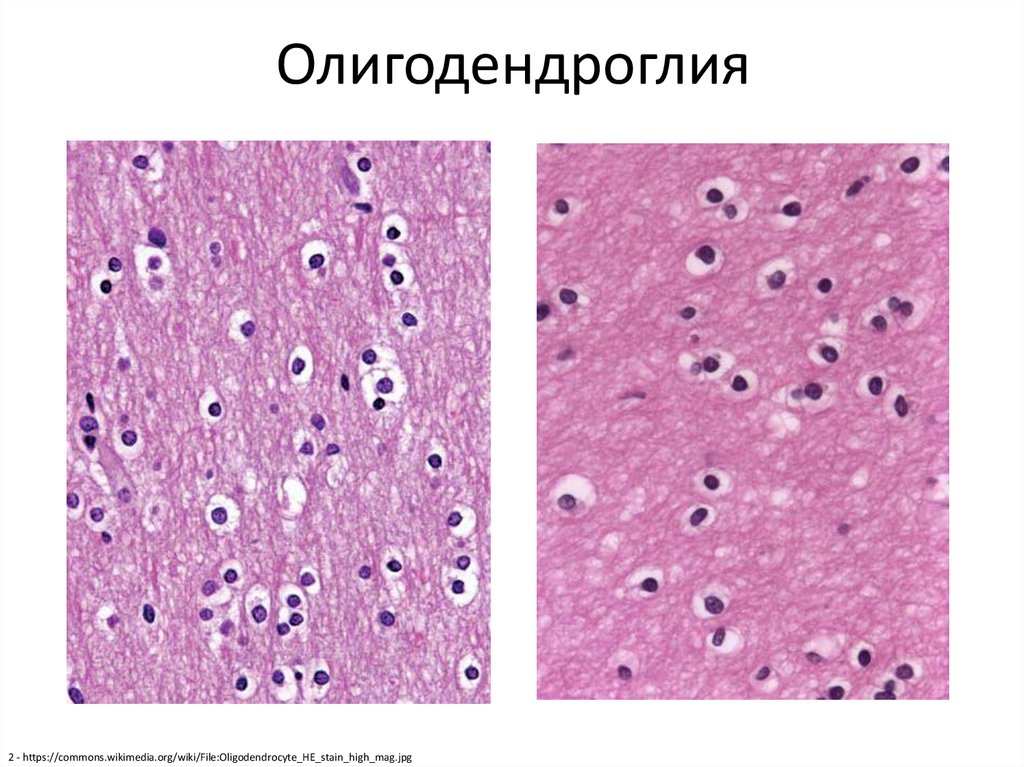 Олигодендроглия