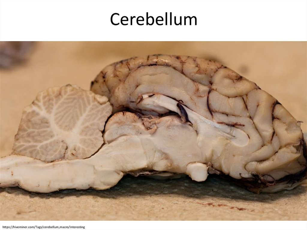 Cerebellum