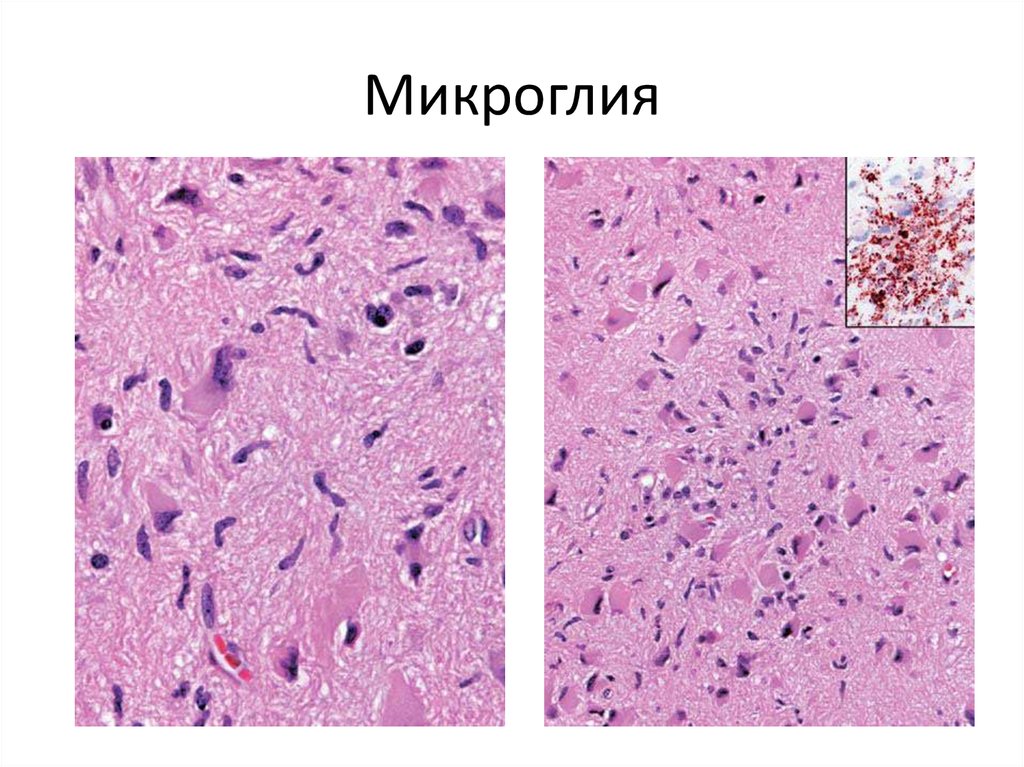 Ткани головного мозга. Микроглия головного мозга гистология. Макроглия гистология. Микроглия гистология препарат. Макроглия и микроглия гистология.