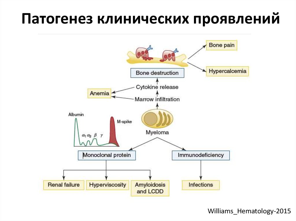 Патогенез множественной миеломы схема