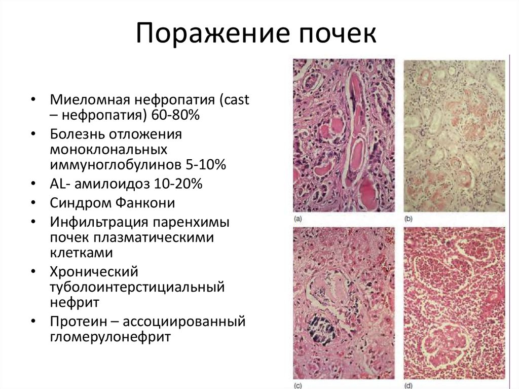 Васкулиты патанатомия презентация