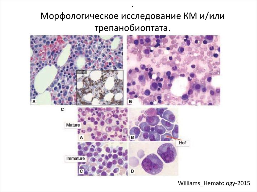 Что значит морфологическая картина