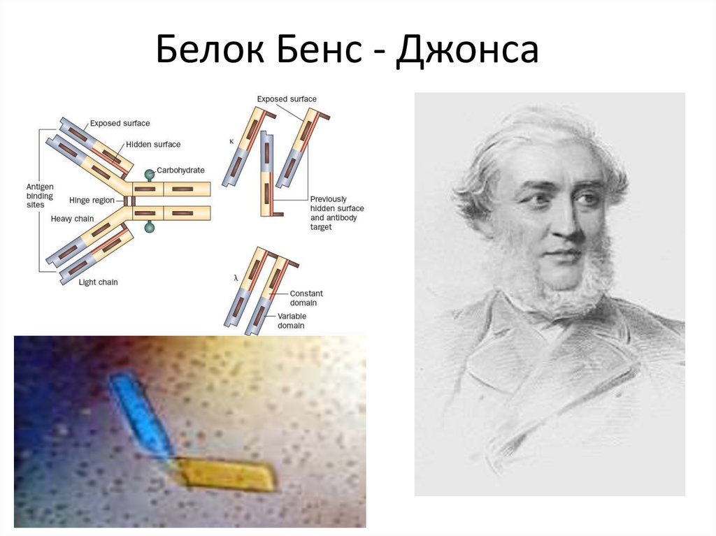 Белок джонса. Белок Бенс Джонса. Исследование белка Бенс-Джонса. Белок Бенс Джонса строение. Белок Бена Джонсона.