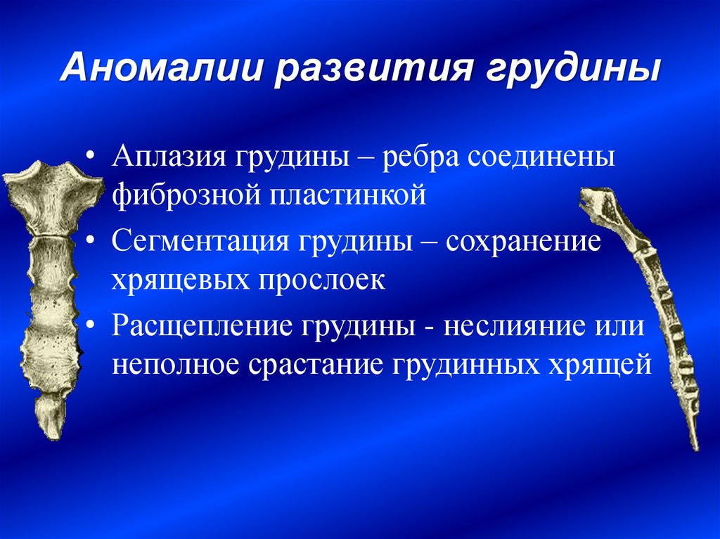 Аномалии развития верхних конечностей презентация