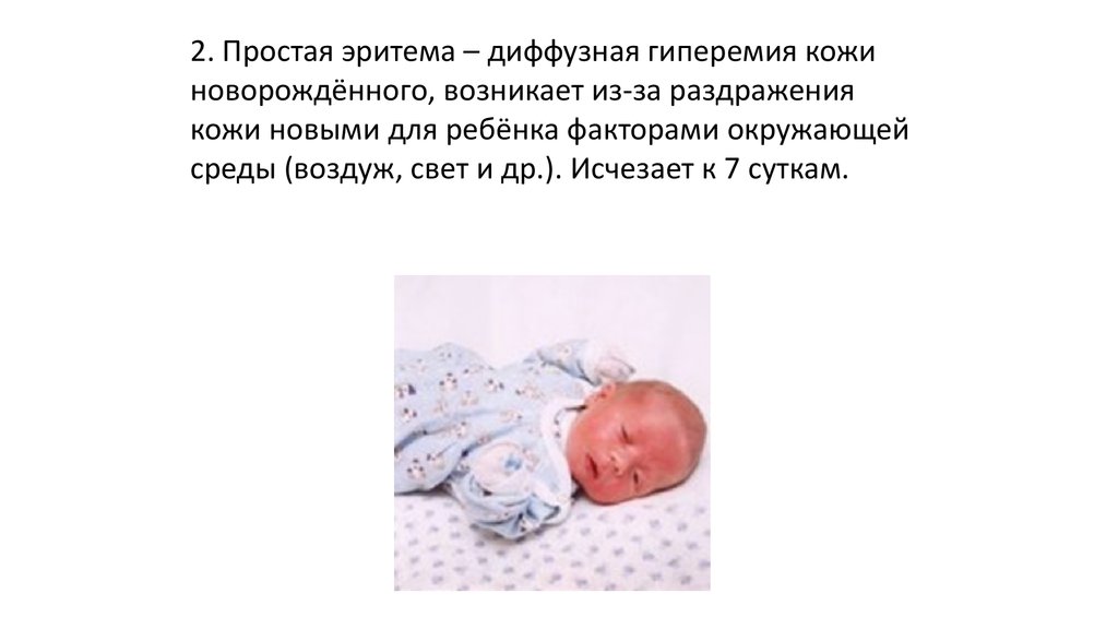 Состояние новорожденности. Пограничные состояния новорожденных токсическая эритема. Простая (физиологическая) эритема.. Физиологическая эритема новорожденного ребенка. Физиологические состояния новорожденных.