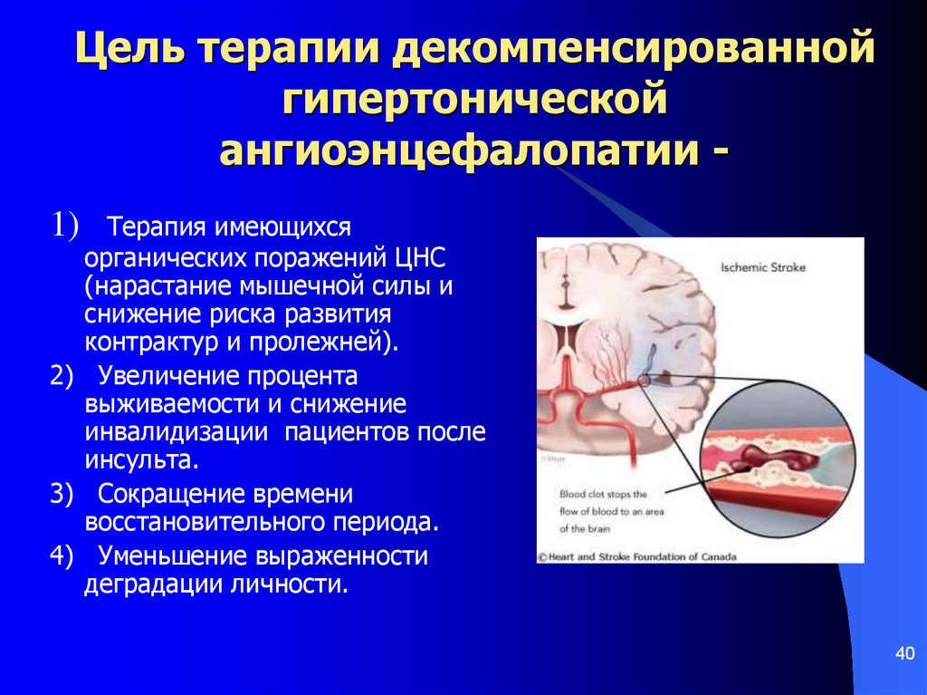 Мр картина ангиоэнцефалопатии