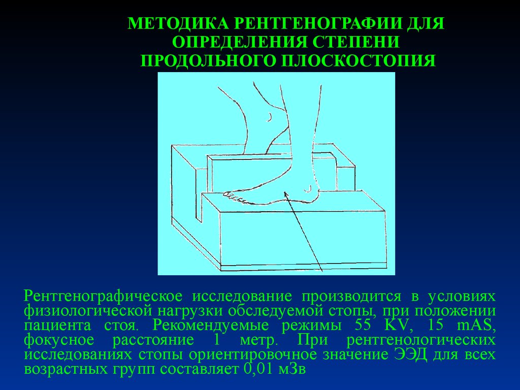 Проекции рентгена стоп. Рентген для выявления плоскостопия. Рентгенологическая оценка продольного плоскостопия. Подставка в рентгене на стопы. Рентгенография стопы при плоскостопии с нагрузкой.