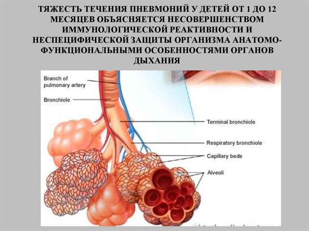 Течение пневмонии. Тяжесть течения пневмонии. Тяжести течения пневмонии у детей. Неспецифическая защита дыхания. Влияние алкоголя на течение пневмонии.