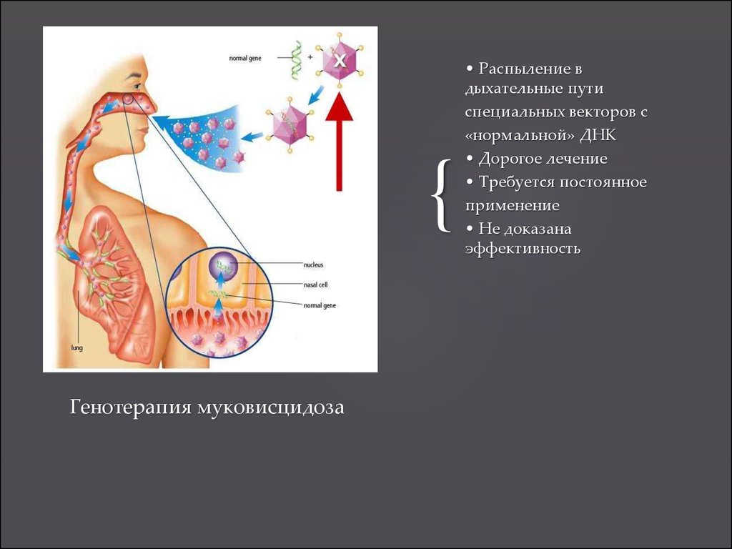 Муковисцидоз презентация по генетике