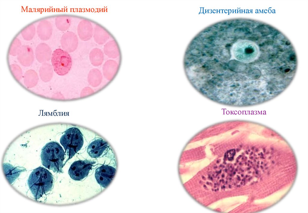 Малярийный плазмодий клетка. Малярийный плазмодий под микроскопом. Малярийный плазмодий систематика. Малярийный плазмодий.