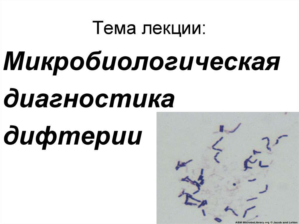 Схема бактериологическая диагностика дифтерии