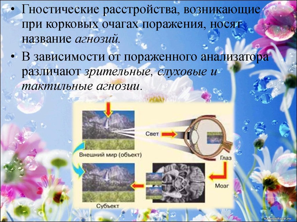 Презентация гностические слуховые расстройства