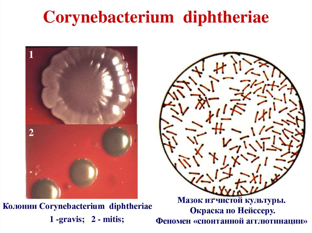 Corynebacterium diphtheriae фото