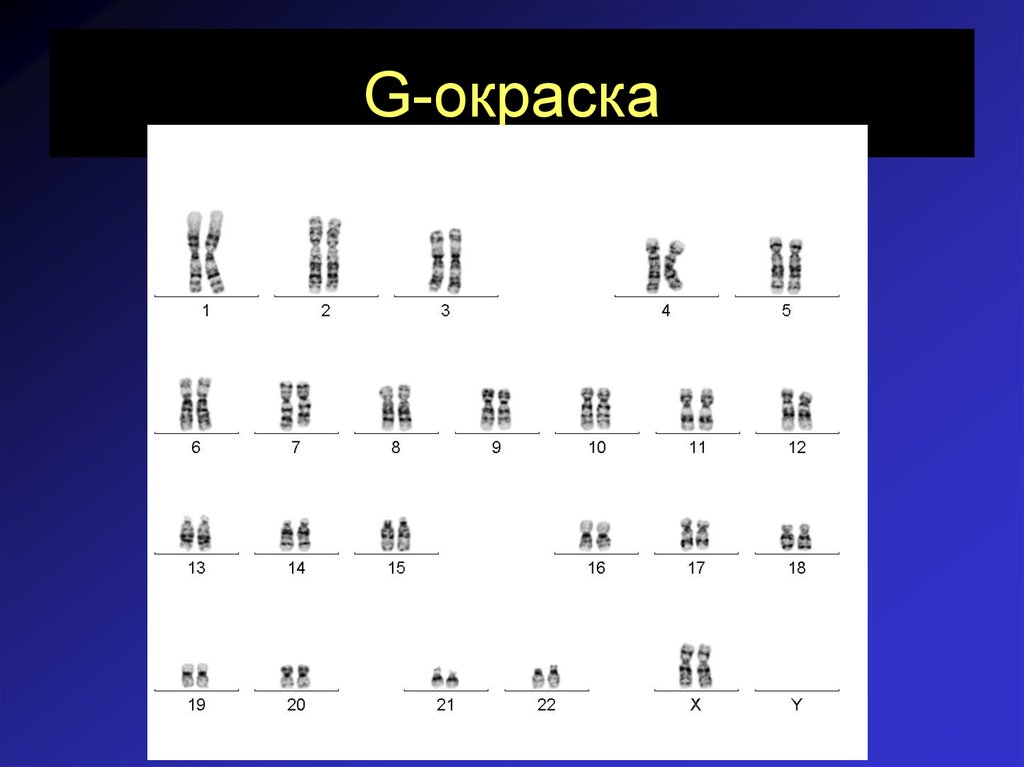 Хромосомная патология. Хромосомные территории. Хромосомные Близнецы. Хромосомная патология 16. Хромосомные тестирование.