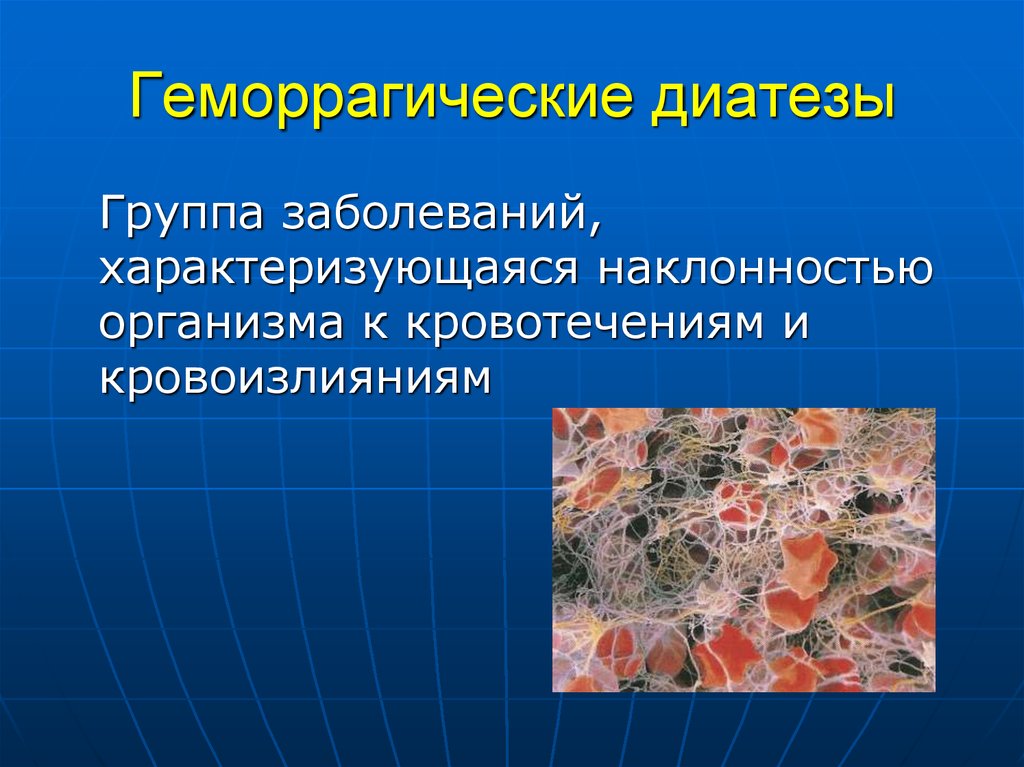 Геморрагические диатезы у детей. Геморрагические диатезы. Геморрагический диатез. Группы геморрагического диатеза. Геморрагический диатез проявления.