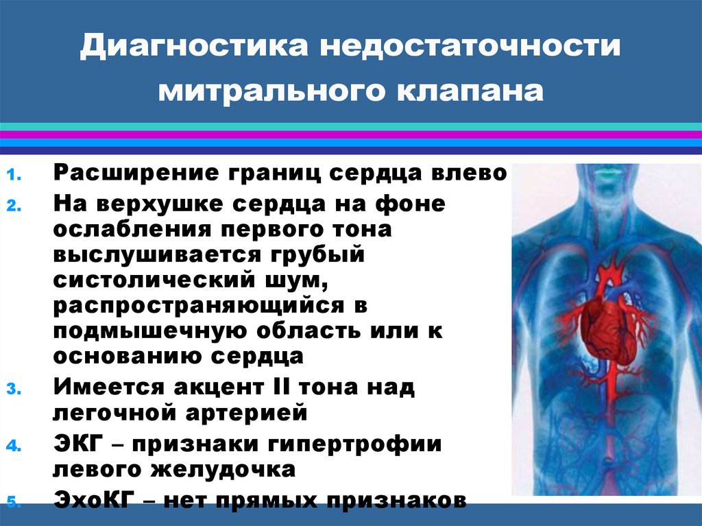 Расширение сердца влево. Митральная клапанная недостаточность. Недостаточность митрального клапана структура. Митральная недостаточность регургитация. Недостаточность митрального клапана диагностика.