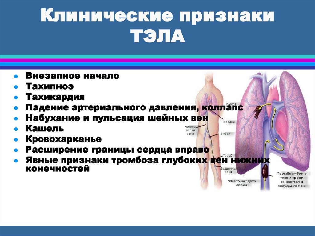 Тромбоэмболия мелких. Тромбоэмболия легочной артерии симптомы. Лёгочная эмболия симптомы. Тэла клинические проявления. Клиническое проявление тромбоэмболии.