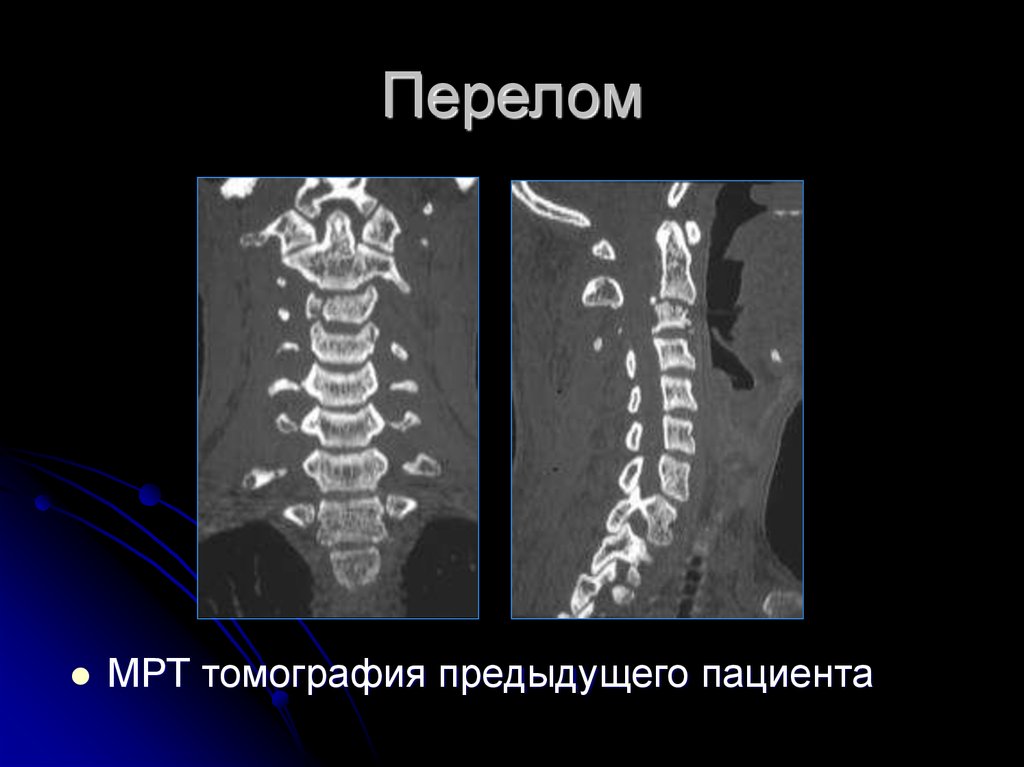 Презентация про позвоночник