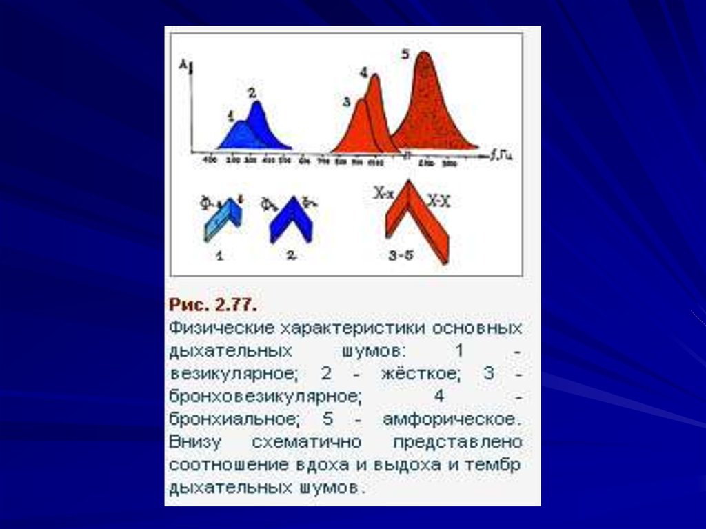 Схемы дыхательных шумов. Схемы основных дыхательных шумов. Основные дыхательные шумы. Схемы основных дыхательных шумов в норме.