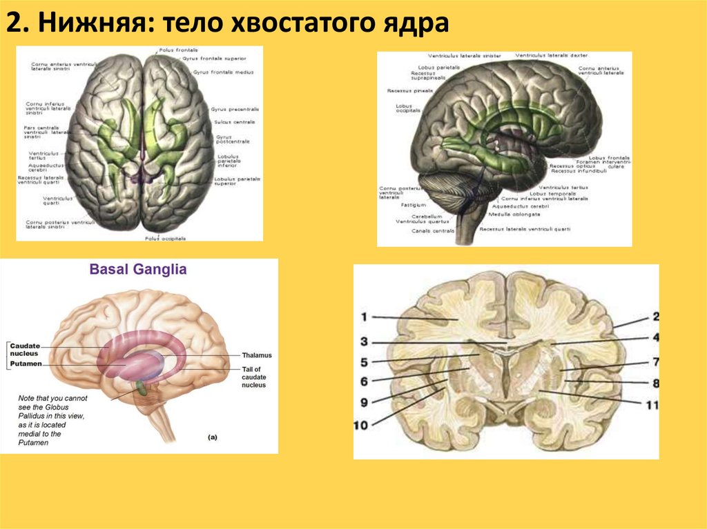 Мозг 2 ответы. Хвостатое тело мозг. Тело хвостатого ядра. Головка хвостатого ядра. Белое вещество конечного мозга.