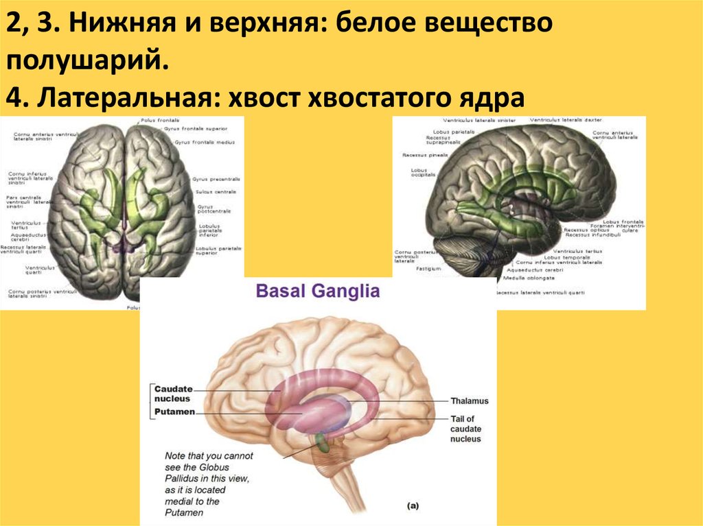 Ядра полушарий большого мозга