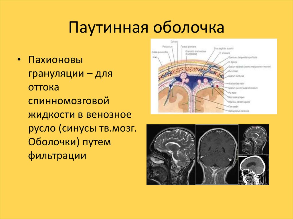 Оболочки мозга мрт