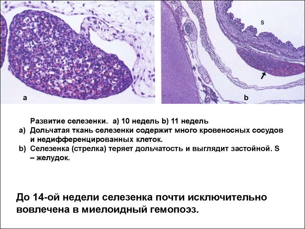 Селезенка гистология презентация