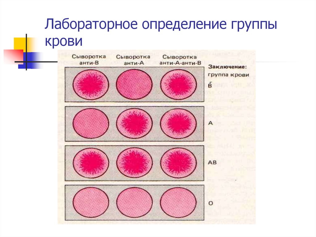Группа крови перекрестный метод. Сывороточный метод определения группы крови. Лабораторные способы определения групп крови. Стандартные изогемагглютинирующие сыворотки для определения группы. Сыворотка 4 группы крови.