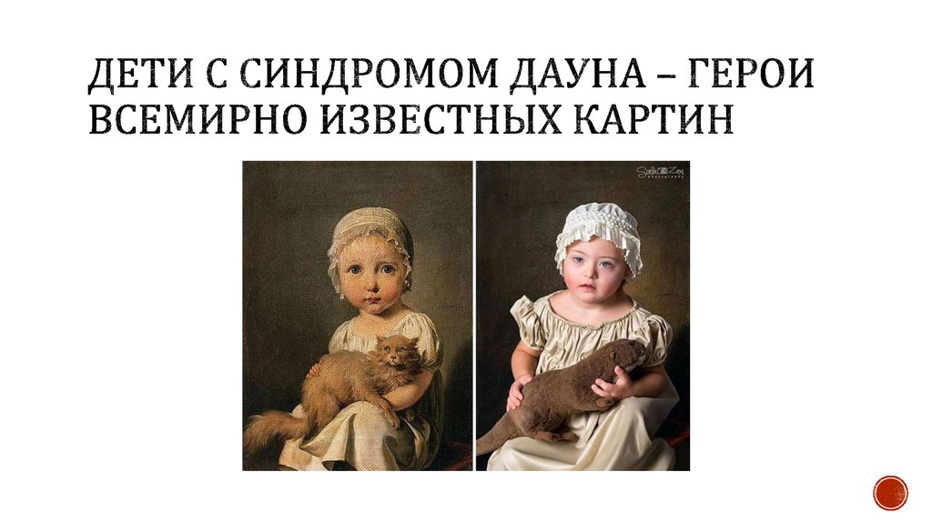 Дети с синдромом ДАУНА – ГЕРОИ ВСЕМИРНО ИЗВЕСТНЫХ КАРТИН