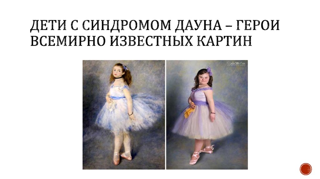 Дети с синдромом ДАУНА – ГЕРОИ ВСЕМИРНО ИЗВЕСТНЫХ КАРТИН