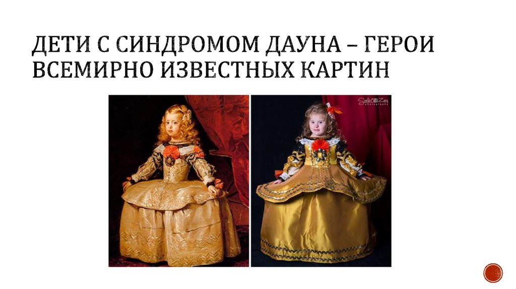 Дети с синдромом ДАУНА – ГЕРОИ ВСЕМИРНО ИЗВЕСТНЫХ КАРТИН