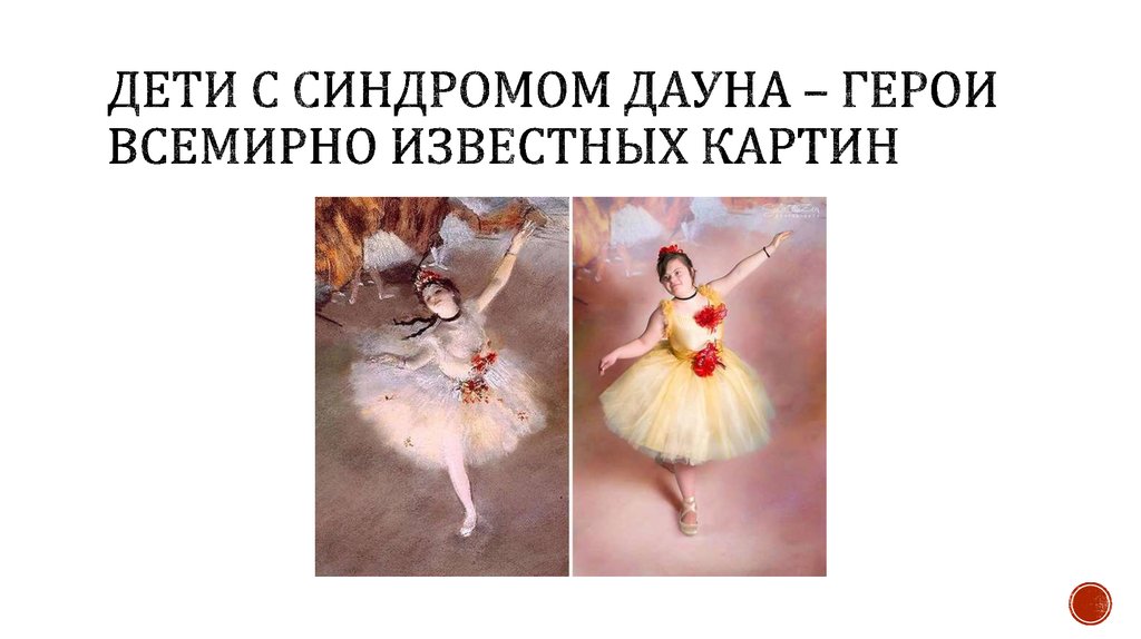 Дети с синдромом ДАУНА – ГЕРОИ ВСЕМИРНО ИЗВЕСТНЫХ КАРТИН