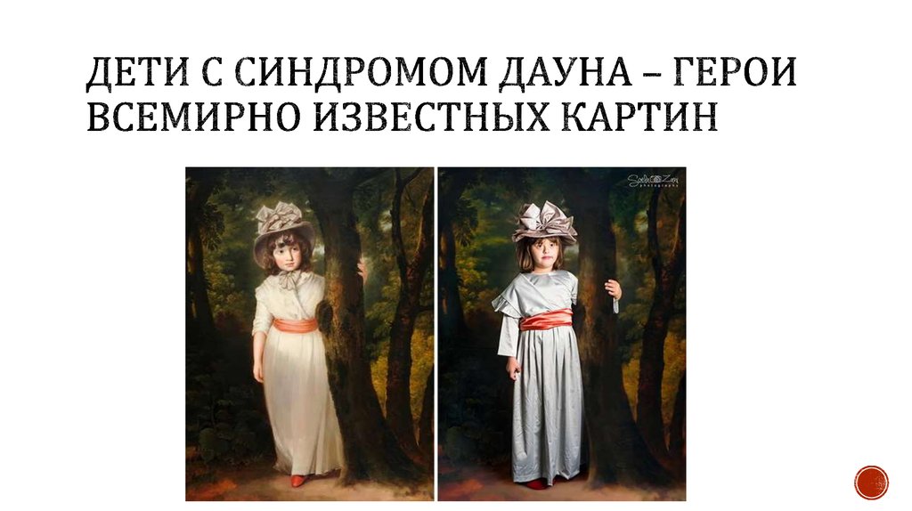 Дети с синдромом ДАУНА – ГЕРОИ ВСЕМИРНО ИЗВЕСТНЫХ КАРТИН