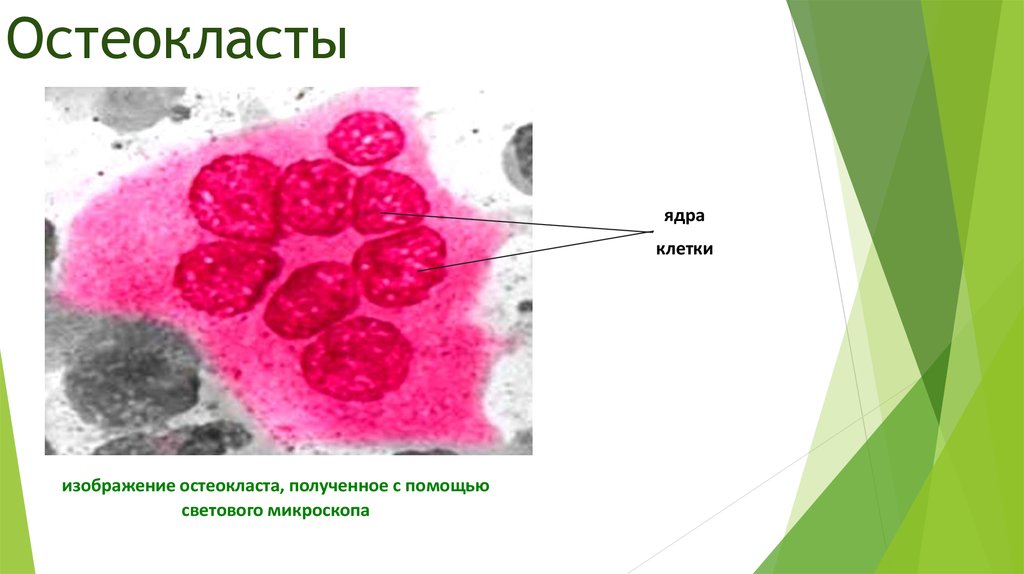 Остеокласты