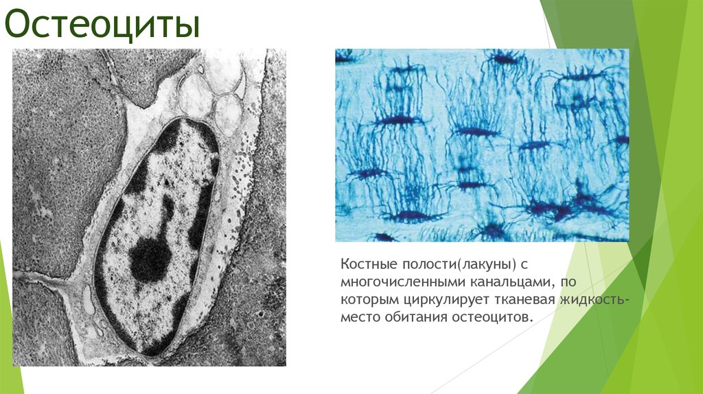 Остеоцит. Лакуны костной ткани. Остеоциты гистология препарат. Остеоциты гистология строение. Остеоциты микроскопия.